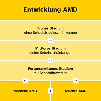 Grafik mit Frühes Stadium AMD/ ohne Seheinschränkungen bis fortgeschrittenes Stadium mit Sehverlust